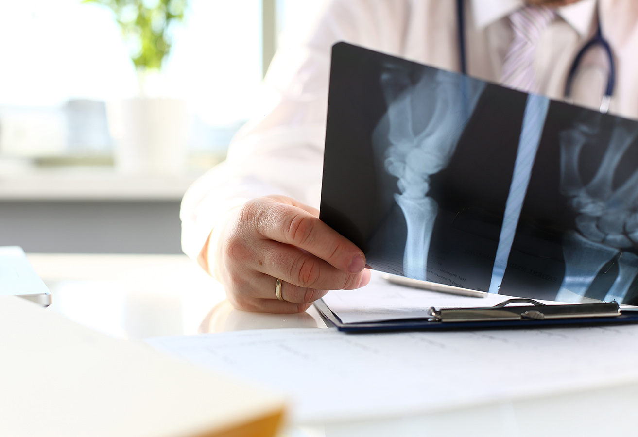 A doctor reviews an X-ray of a joint